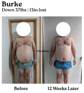 Photo of Burke GLP-1 Before and After