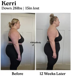 Photo of Kerri GLP-1 Before and After